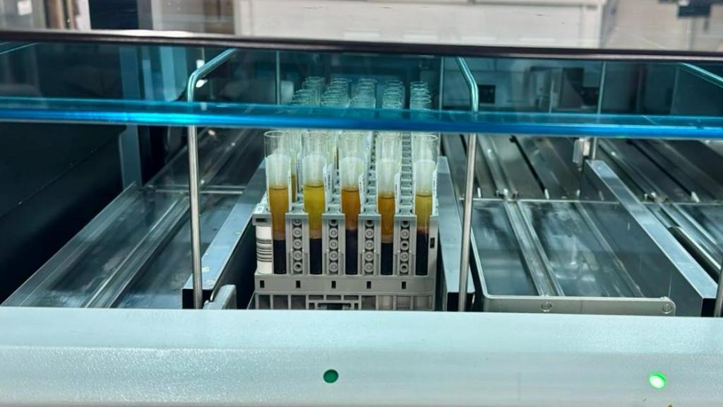 MT Hemocentro realiza 4,8 mil exames para captação de órgãos em 12 meses